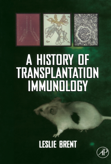 History of Transplantation Immunology