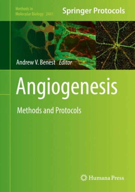 Angiogenesis