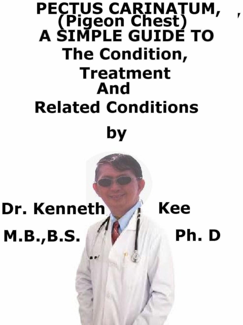 Pectus Carinatum, (Pigeon Chest) A Simple Guide To The Condition, Treatment And Related Conditions